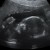 Imagen de avatar